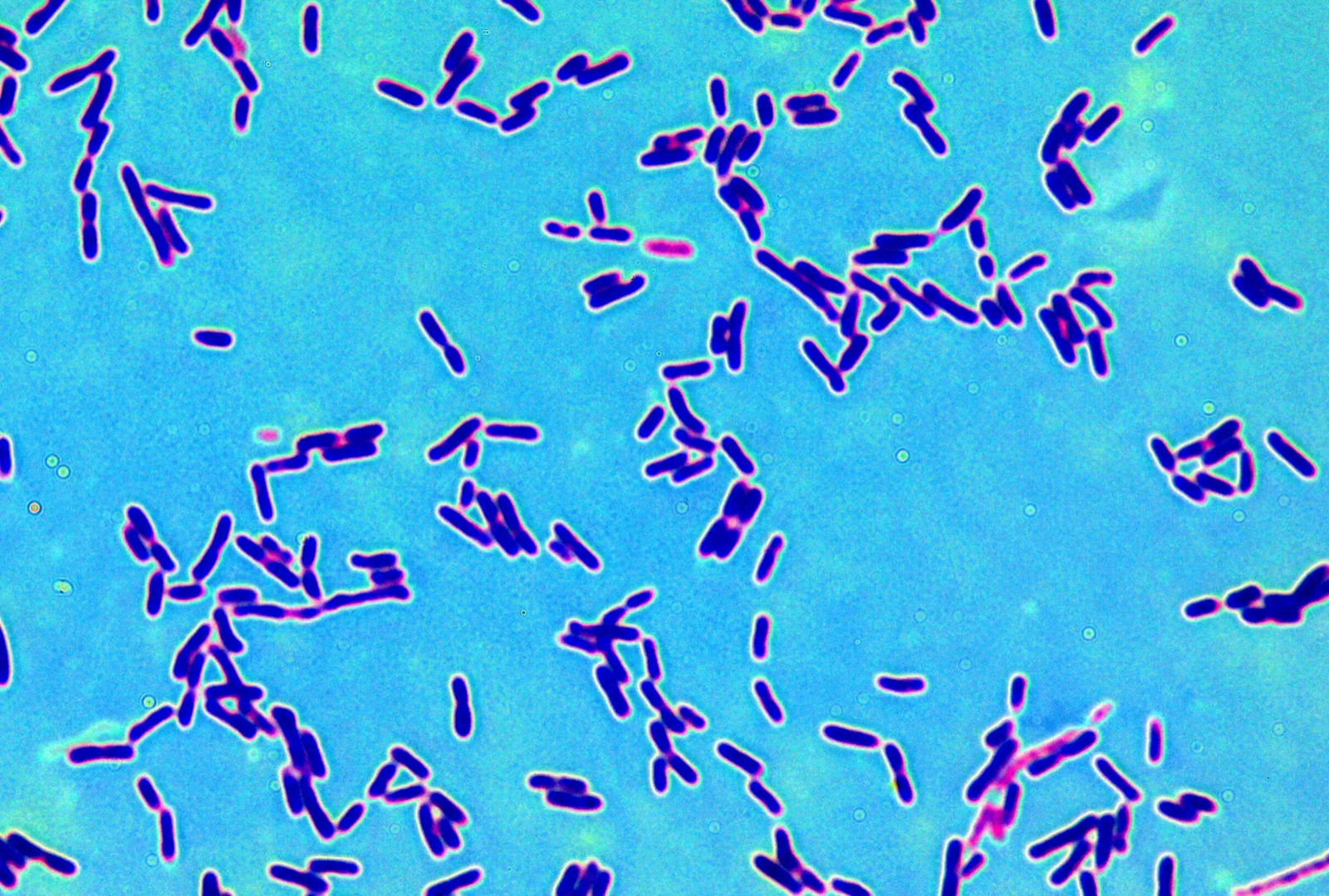 Probiotics & Prebiotics