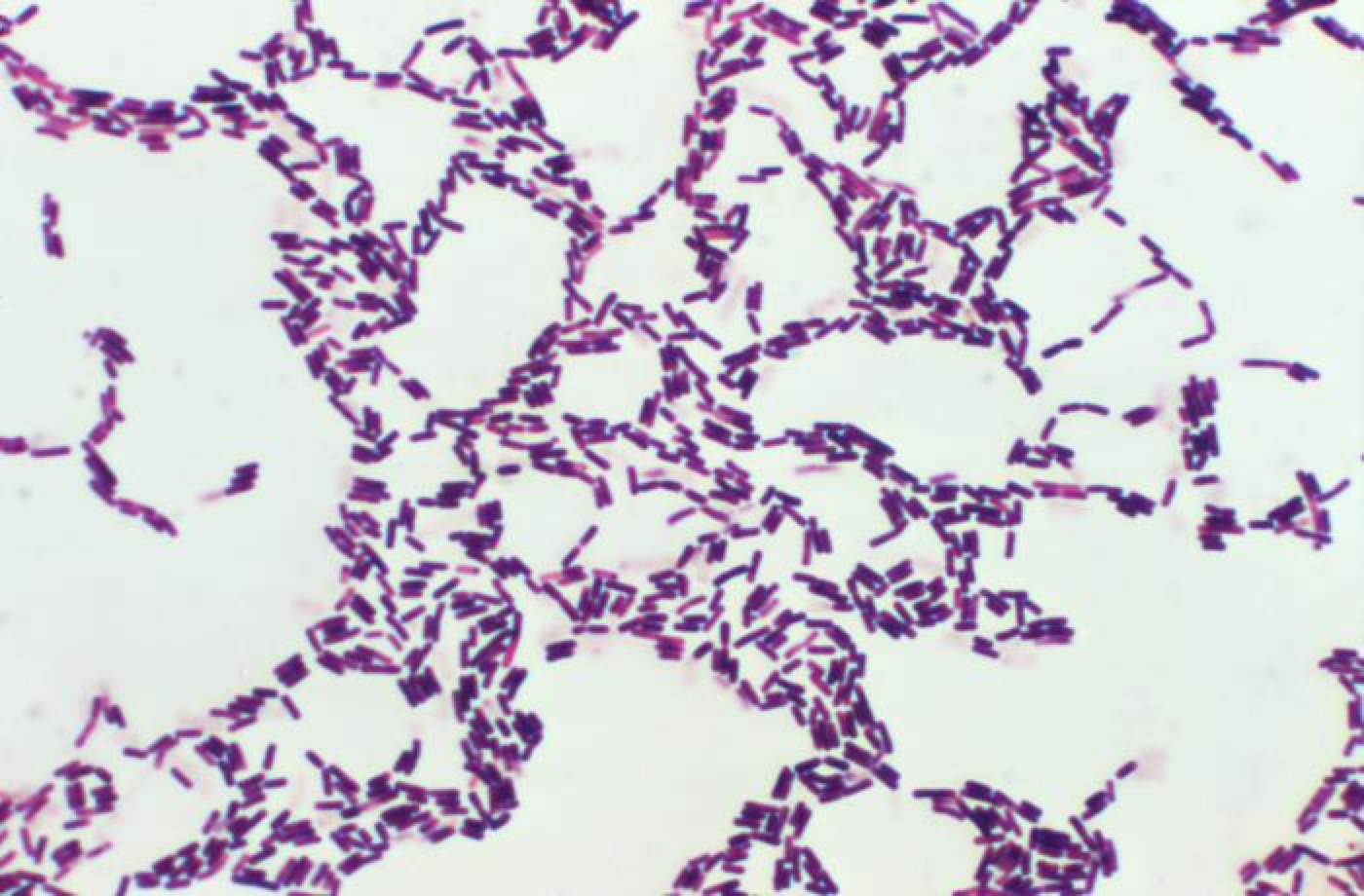 Digestive enzyme and probiotic blend