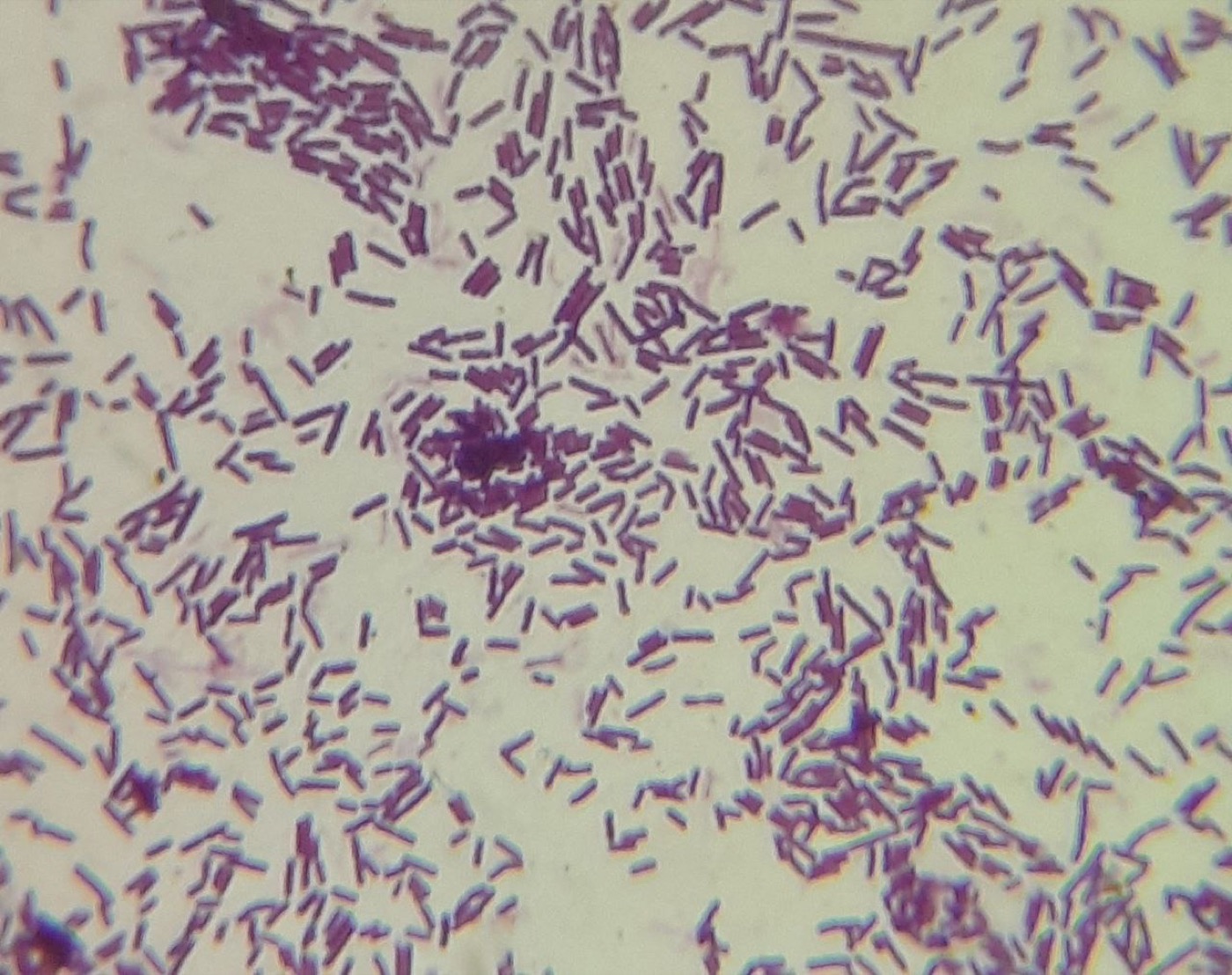 Lactobacillus reuteri