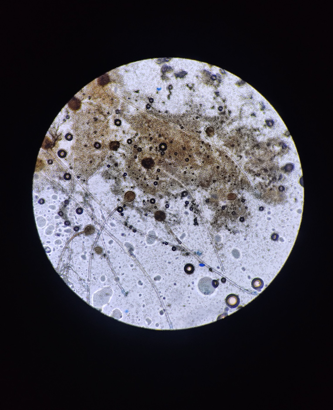 Lipase